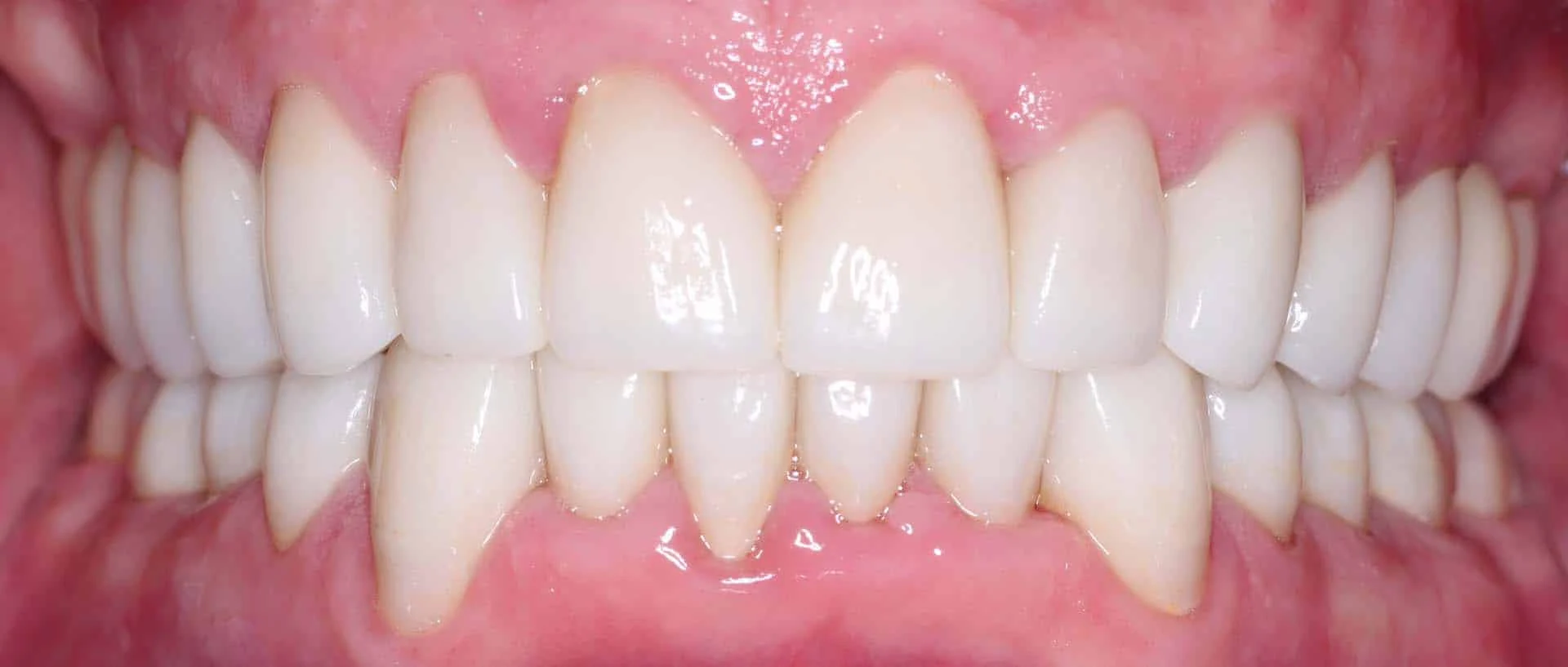 Copy-of-Vern-S-After-Facial