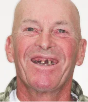 0553 1 - Card - Patient Testimonial